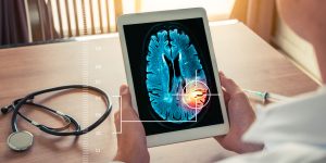 Doctor looking at a brain scan on a tablet with augmented reality graphics overlaid on image.